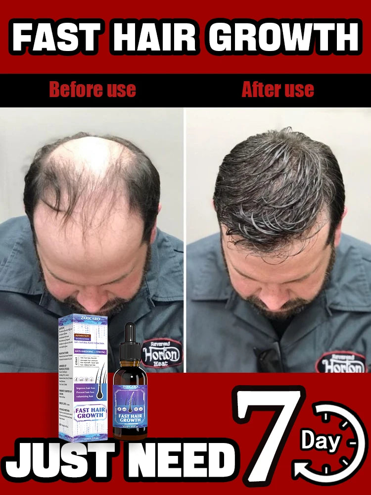 Crescimento capilar impressionante mostrado com RevitaHair Pro da Selluve. A imagem Antes mostra afinamento, enquanto depois revela volume. O texto destaca CRESCIMENTO RÁPIDO DO CABELO e SÓ PRECISA DE 7 DIAS. Diga adeus à queda de cabelo!.