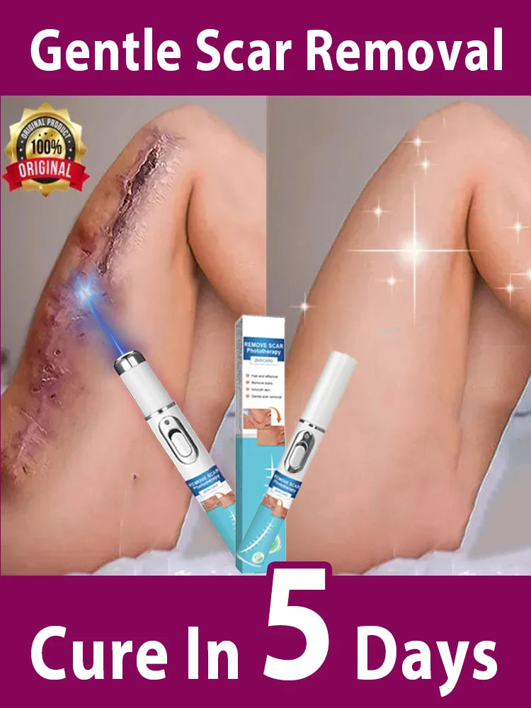 Um anúncio apresenta os Produtos para cicatrizes da Selluve, uma tecnologia inovadora de remoção de cicatrizes com um aplicador de creme azul e branco que emite luz. Um visual compara a pele cicatrizada com a cicatrizada, afirmando: Remoção suave de cicatrizes, cura em 5 dias. Descubra a renovação da pele eficaz hoje mesmo!.